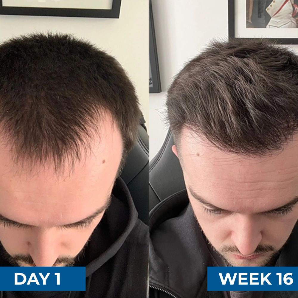 Hair Generating Rolling Fluid